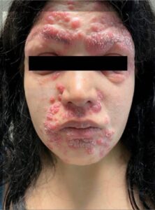 These are the consequences of sleeping co... See more - NewzTimes21.com