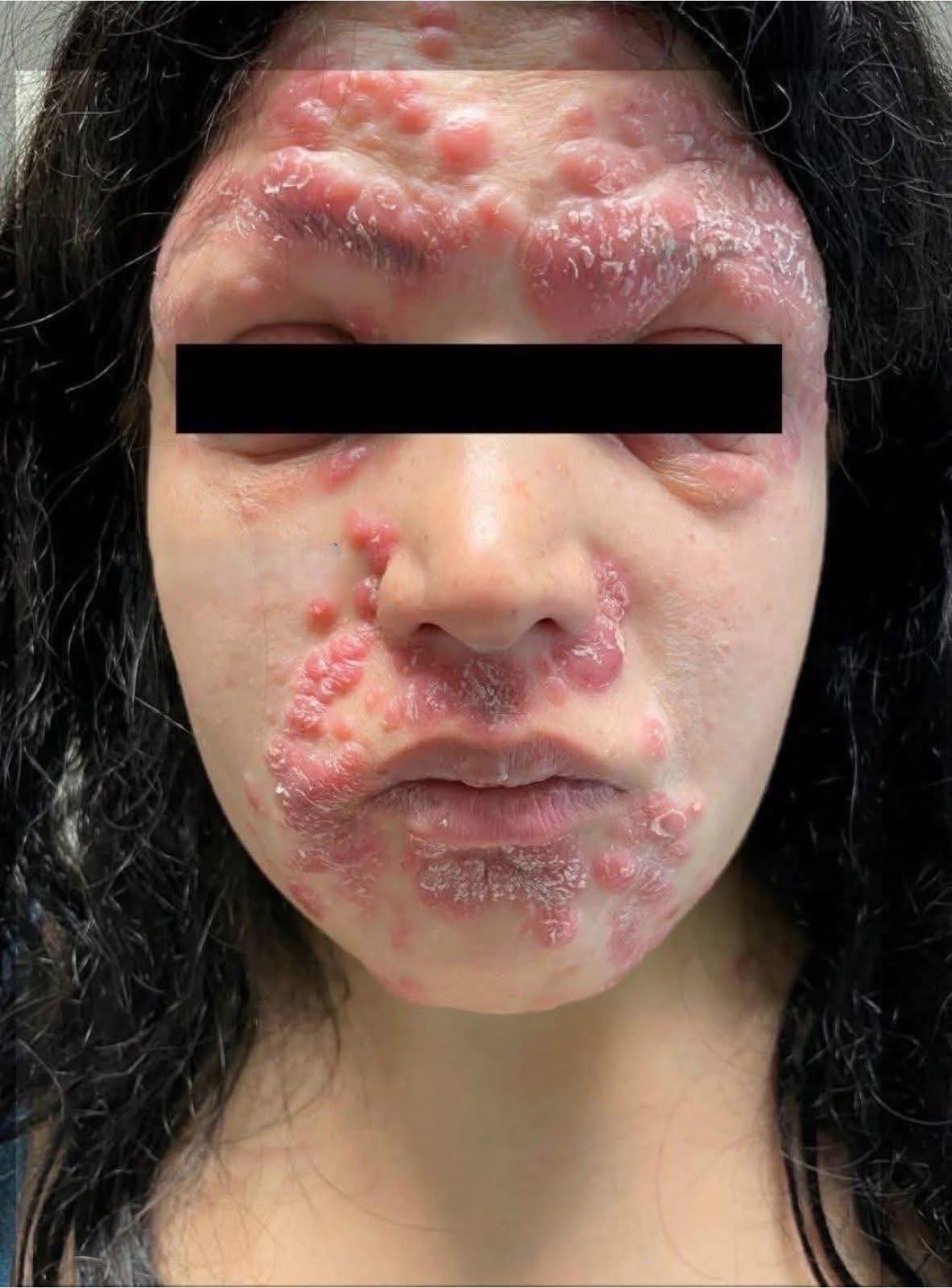 These are the consequences of sleeping co... See more - NewzTimes21.com