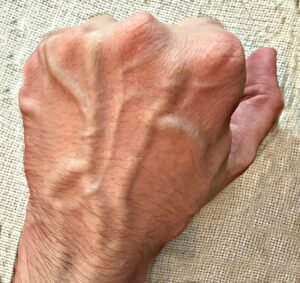 What Prominent Hand Veins Really Mean
