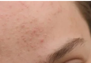 RED DOTS ON YOUR SKIN: CAUSES AND WHAT THEY MIGHT REPRESENT RED DOTS ON YOUR SKIN: CAUSES AND WHAT THEY MIGHT REPRESENT