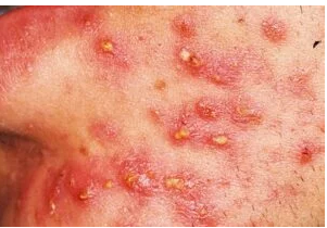 RED DOTS ON YOUR SKIN: CAUSES AND WHAT THEY MIGHT REPRESENT RED DOTS ON YOUR SKIN: CAUSES AND WHAT THEY MIGHT REPRESENT