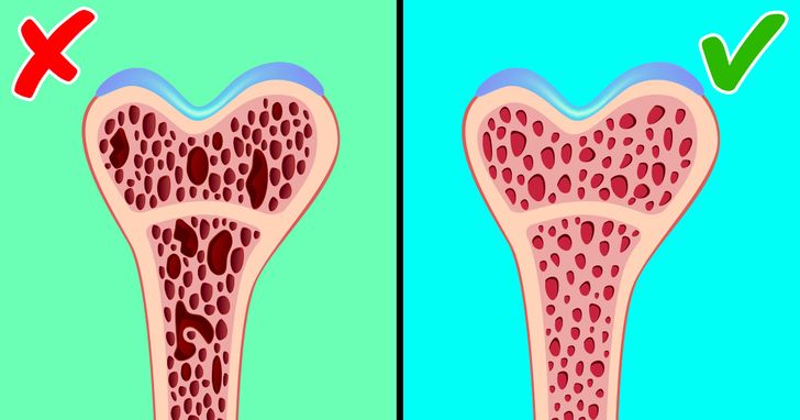 Your Bones Get Weaker Year After Year, but There Are Ways to Keep Them Healthy