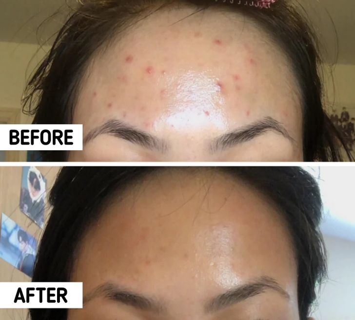 It’s absolutely possible to reduce this problem if you pick the right treatment and do some basic cleaning procedures.