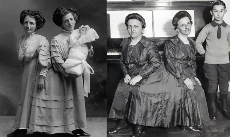 The Incredible Story of the Siamese Twins: One Fell in Love, Had a Baby — and Both Became Mothers… The Incredible Story of the Siamese Twins: One Fell in Love, Had a Baby — and Both Became Mothers…