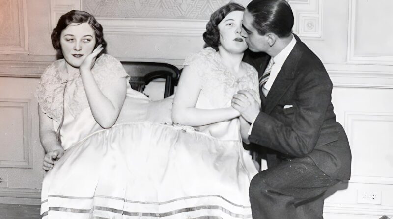 The Incredible Story of the Siamese Twins: One Fell in Love, Had a Baby — and Both Became Mothers… The Incredible Story of the Siamese Twins: One Fell in Love, Had a Baby — and Both Became Mothers…