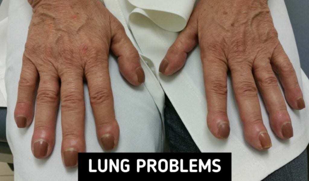 8 body symptoms you should be aware of 8 body symptoms you should be aware of