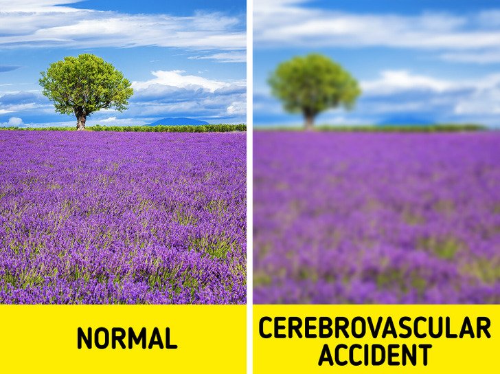 12 Unusual Eye Changes That Might Predict Serious Health Issues 12 Unusual Eye Changes That Might Predict Serious Health Issues