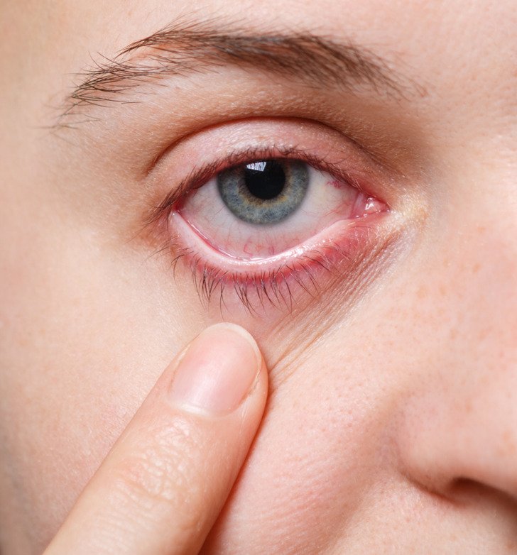 5. Loss of peripheral vision.