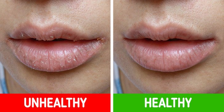 7 Warning Signs Your Body Might Be Revealing Health Issues