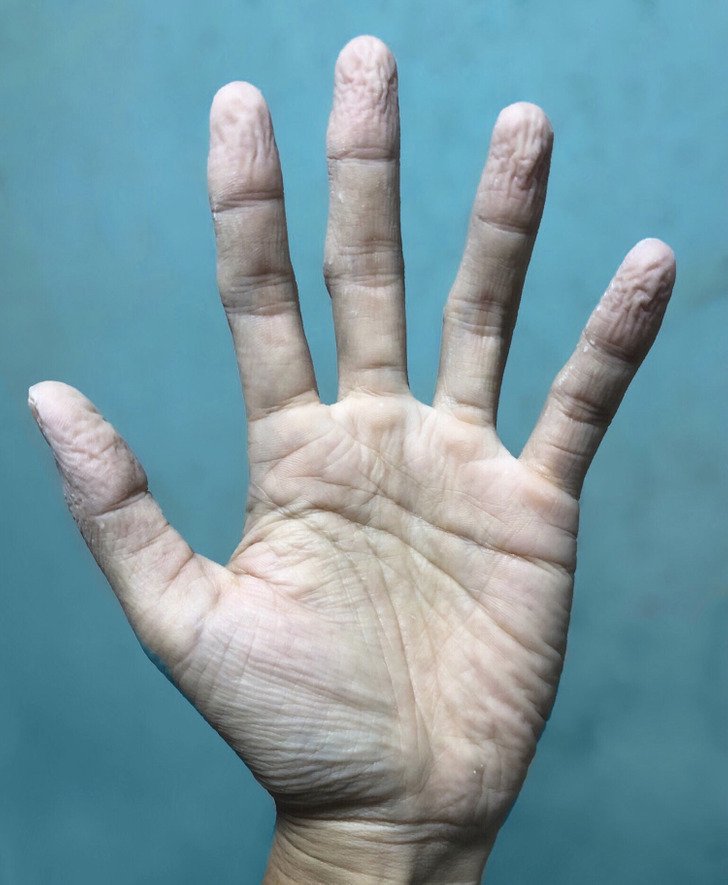 7 Warning Signs Your Body Might Be Revealing Health Issues