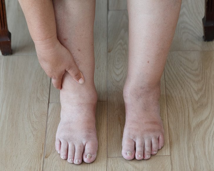 7 Warning Signs Your Body Might Be Revealing Health Issues