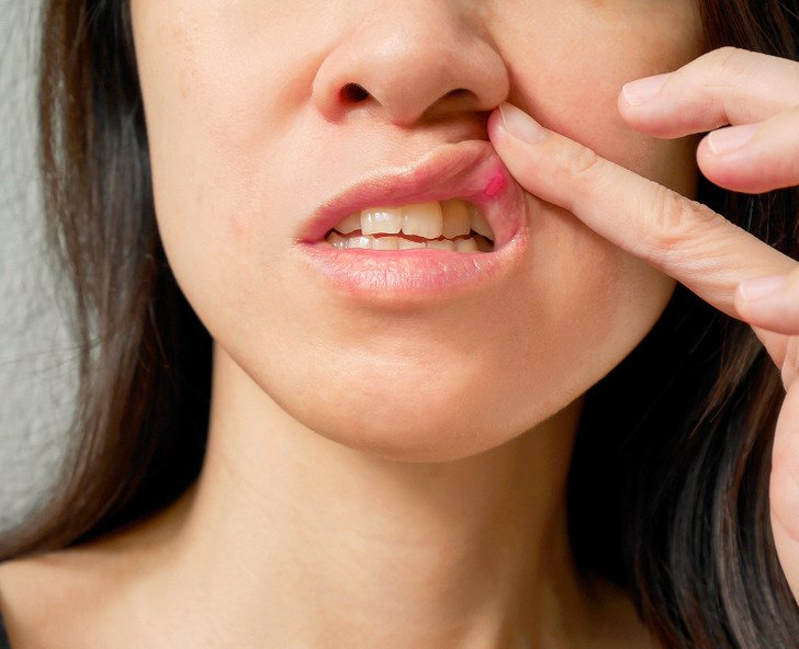 7 Warning Signs Your Body Might Be Revealing Health Issues