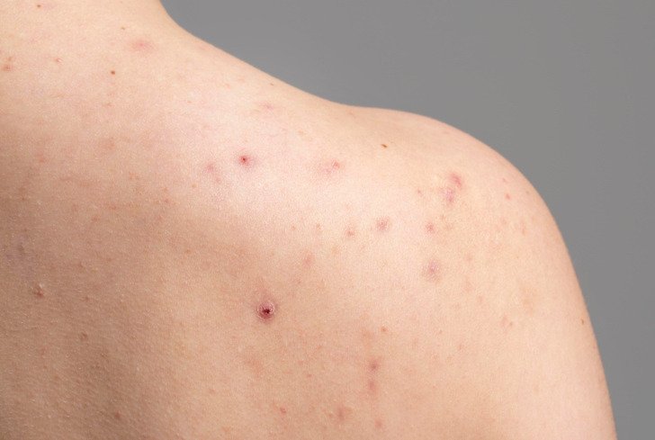 5 Alarming Ways Your Body Might Be Signaling Health Problems