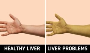8 body symptoms you should be aware of