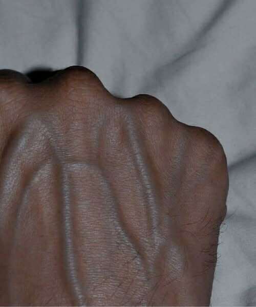 Visible Veins Explained: Normal Causes, Health Risks, and When to Worry