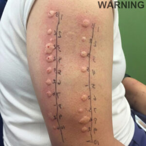 These are the consequences of sleeping with the…