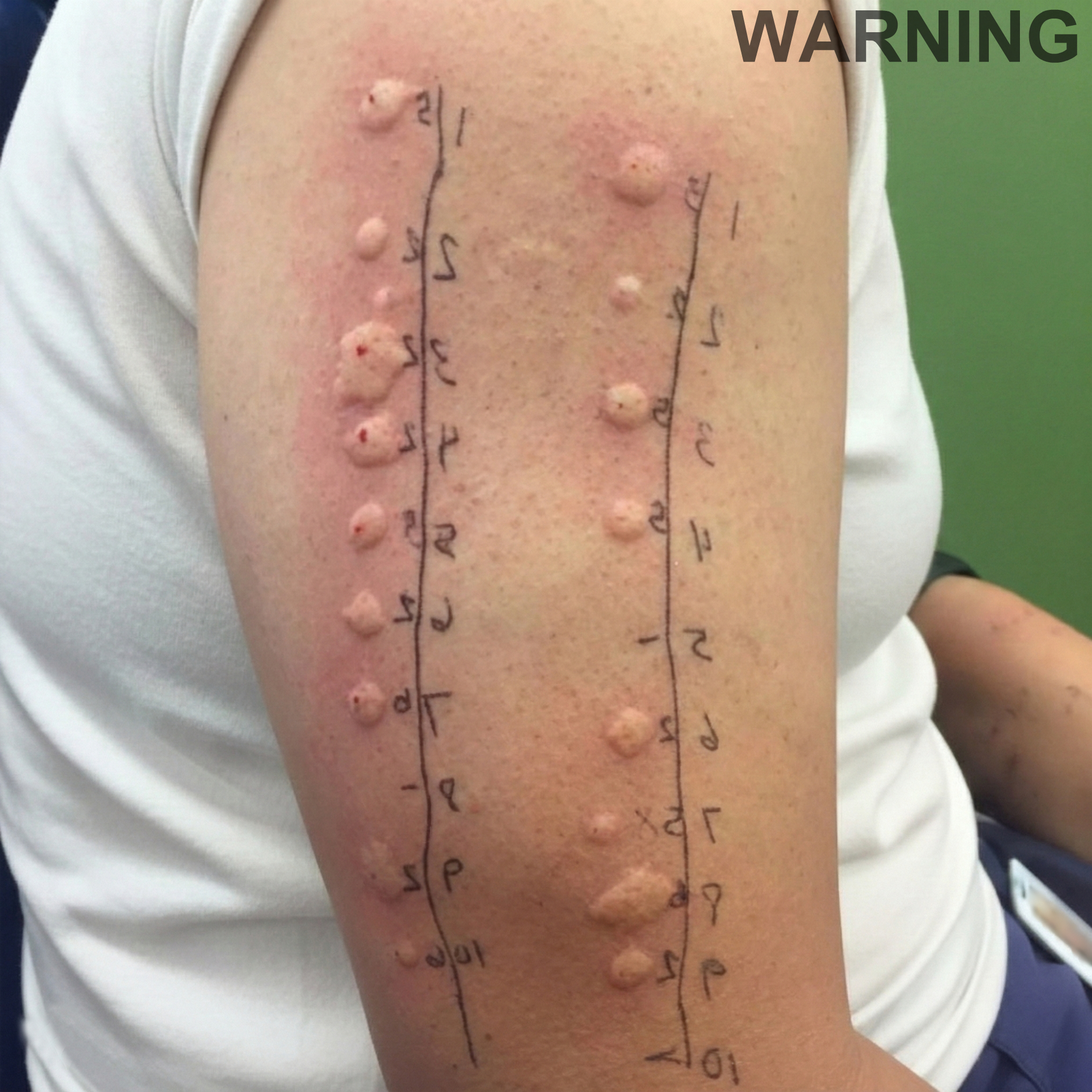 These are the consequences of sleeping with the…