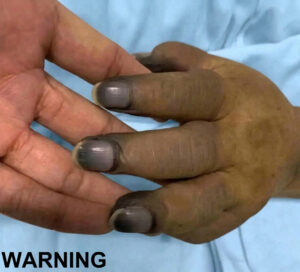 These are the consequences of painting your nails with…