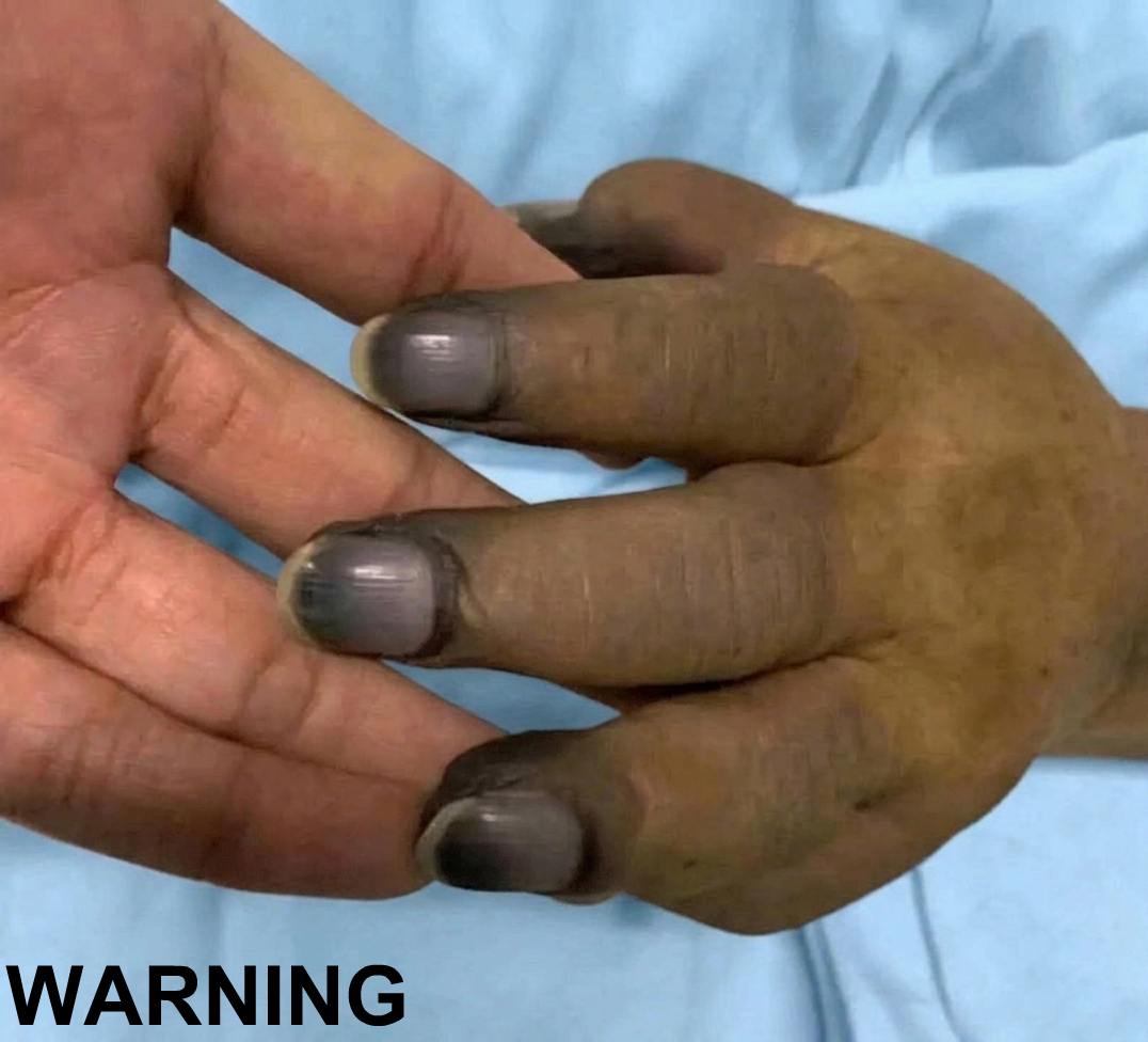 These are the consequences of painting your nails with…