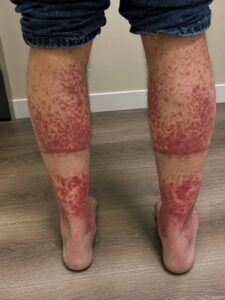These are the consequences of sleeping with…See more