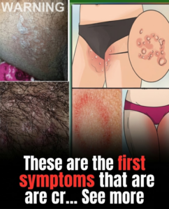 SB. These are the signs that he is cr… See more