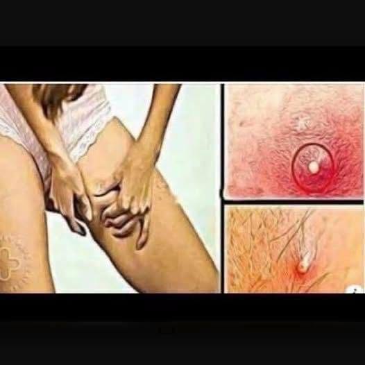 A Skin Warning People Should Notice
