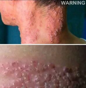🚨 These are the serious consequences of eating... See more