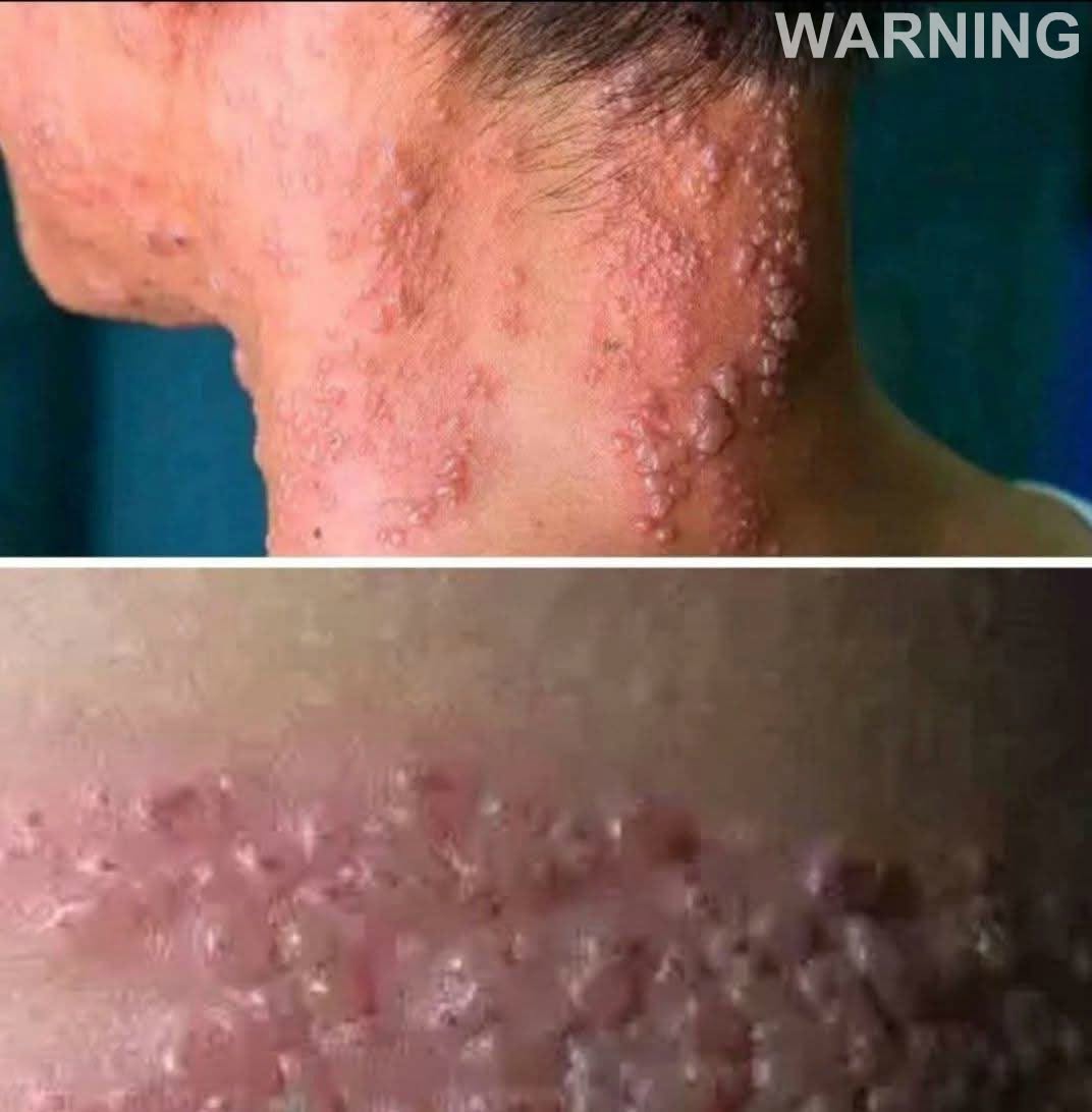 🚨 These are the serious consequences of eating... See more